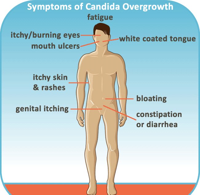 CandidaProtocol's tweet image. #CandidaOvergrowth Symptoms