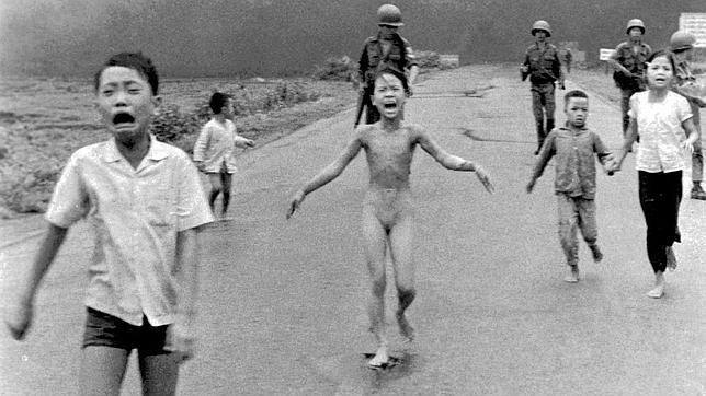 La niña de la icónica fotografía de Vietnam recibe tratamiento para curar dolor crónico ww.abc.es/TPQPv