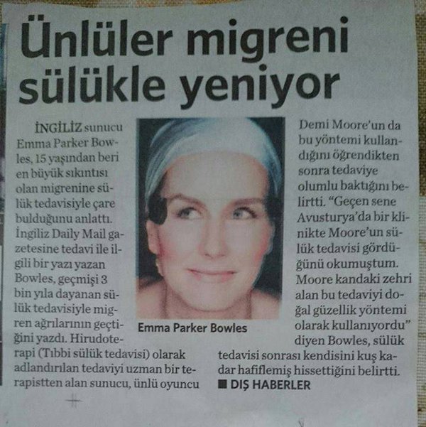 medicinalleech's tweet photo. #Migren #sülük tedavisi https://t.co/1fki48PcNO