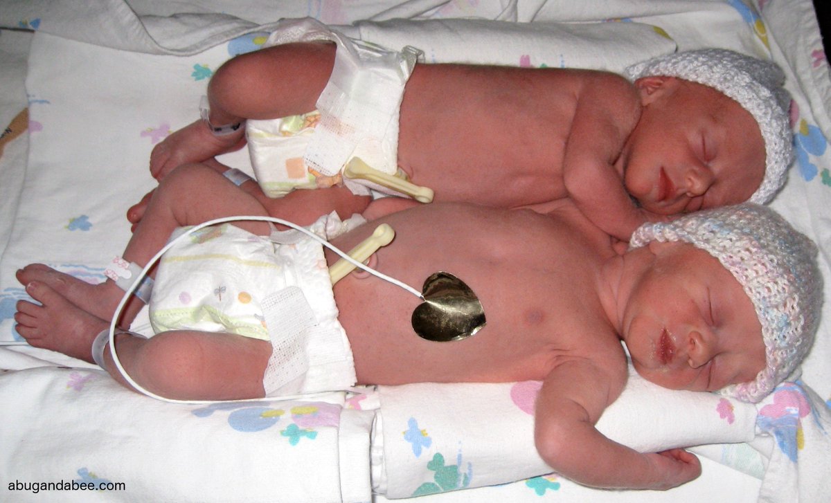 abugandabee's tweet image. #Daddy&apos;s all right. Her CC&apos;s cool 2. But some dreams require the big guns.
abugandabee.com/?p=3002 #parenting #twins