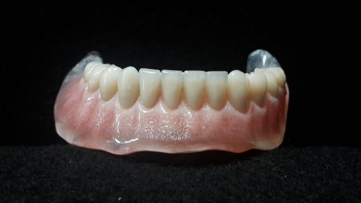 Full Lower #Ivobase denture with #Enigma teeth and colour-tone gingival colouring #dentistry #laboratory #northeast