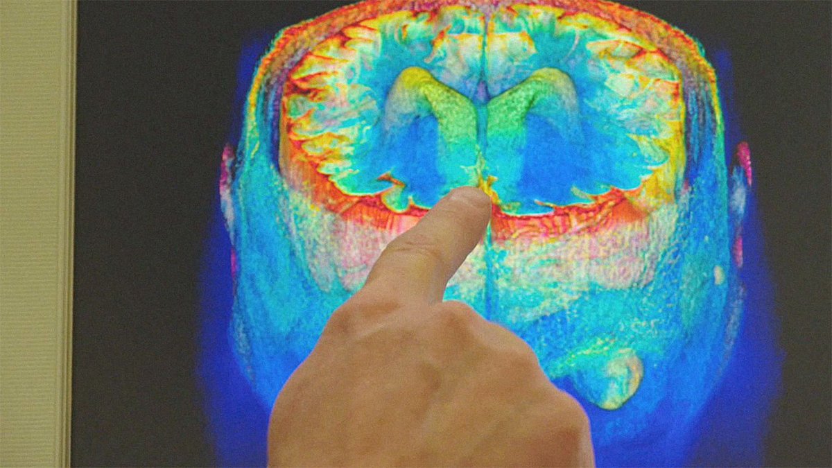 upshot_agency's tweet image. Inside an Exceptionally #Creative Brain: fastcocreate.com/3052659/what-h… #creativity #creativitythinking #creativeminds