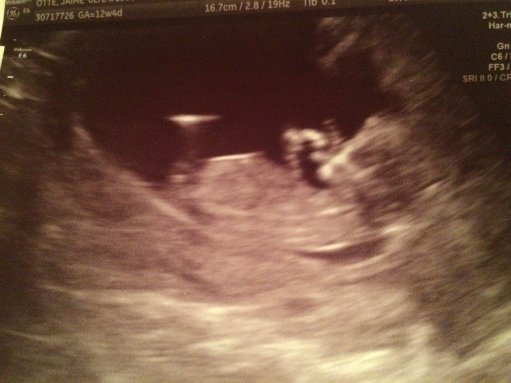 Nate Ottë tweet media