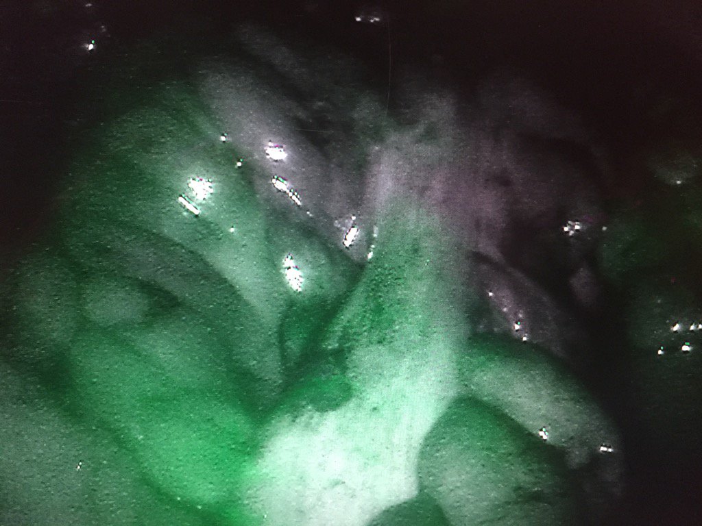 rogier_crolla's tweet photo. #Firefly #fluorescense in last 19 low anterior cases. 4 changed resection line, 4 no ileostomy #colorectal https://t.co/Cr98I7aY8Y
