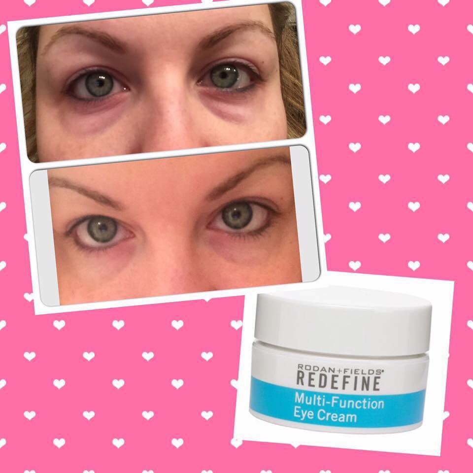 Klhiggins1's tweet photo. Who wants #FREE #Rodan+Fields #Eyecream!!! This offer is only good for 48hrs!! Ask how!! https://t.co/wFb2NkmcVy