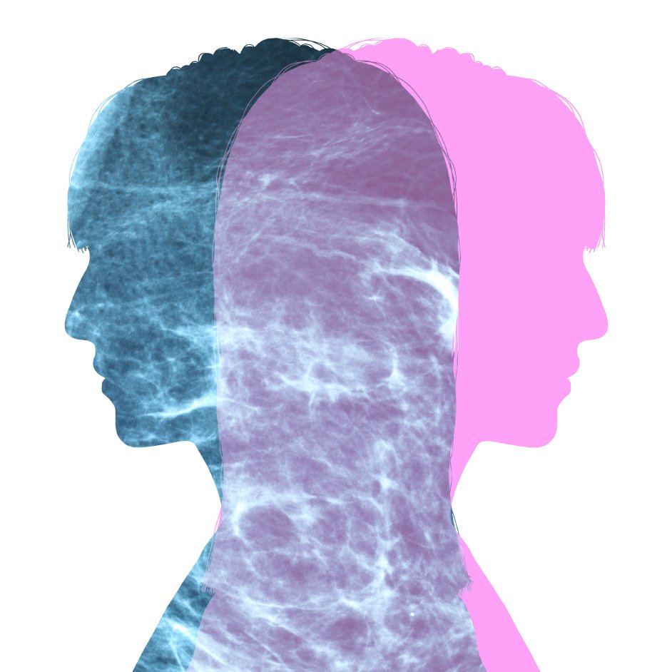 On the Fence: The Pros and Cons of Breast Screening curetoday.com/publications/c…