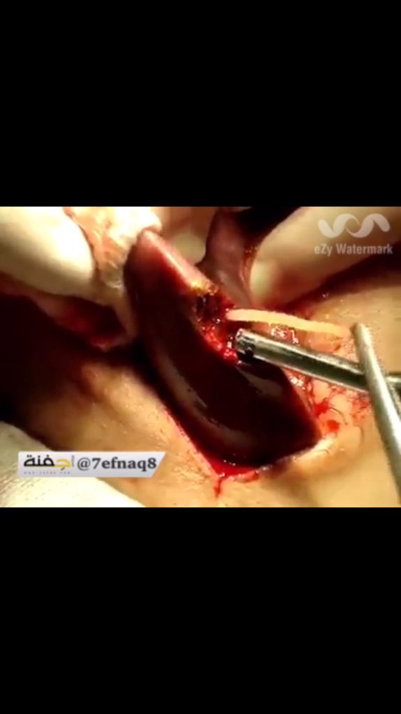 Q8_shayep tweet picture