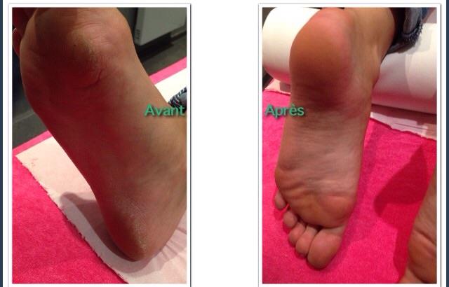 EmelFee's tweet image. pensez au soin des pieds calluspeling En 45 min vos pieds sont régénérer
plus de peaux mortes !!! Chez @EmelFee