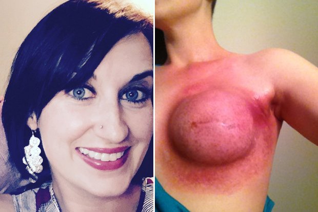 Raw Boobs 93