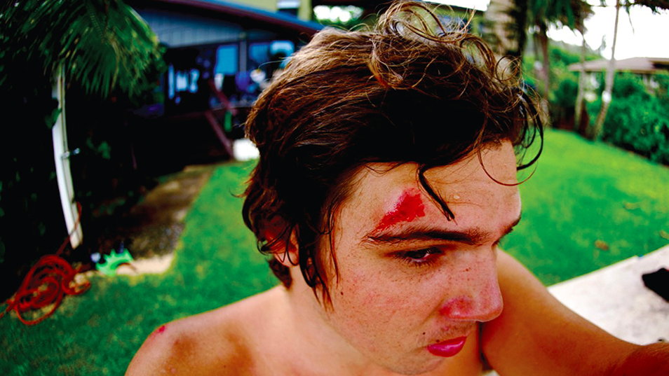 SurfersJournal's tweet photo. Worst. Session. Ever. @postsurf pays tribute to surfing's dreaded moments of injury :https://t.co/XwsR8TYSE2 https://t.co/dDoSgMPGmN