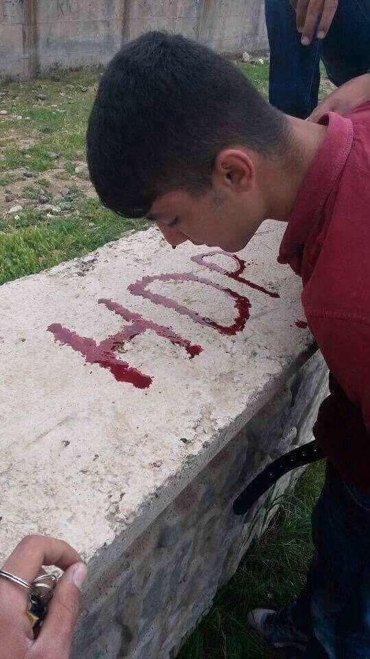 Barış güvercini Hdplilerin masum gencin burnunu kırıp akan kanıyla yaptığı bir çalışma.
Ne kadar barışçıl değil mi? "