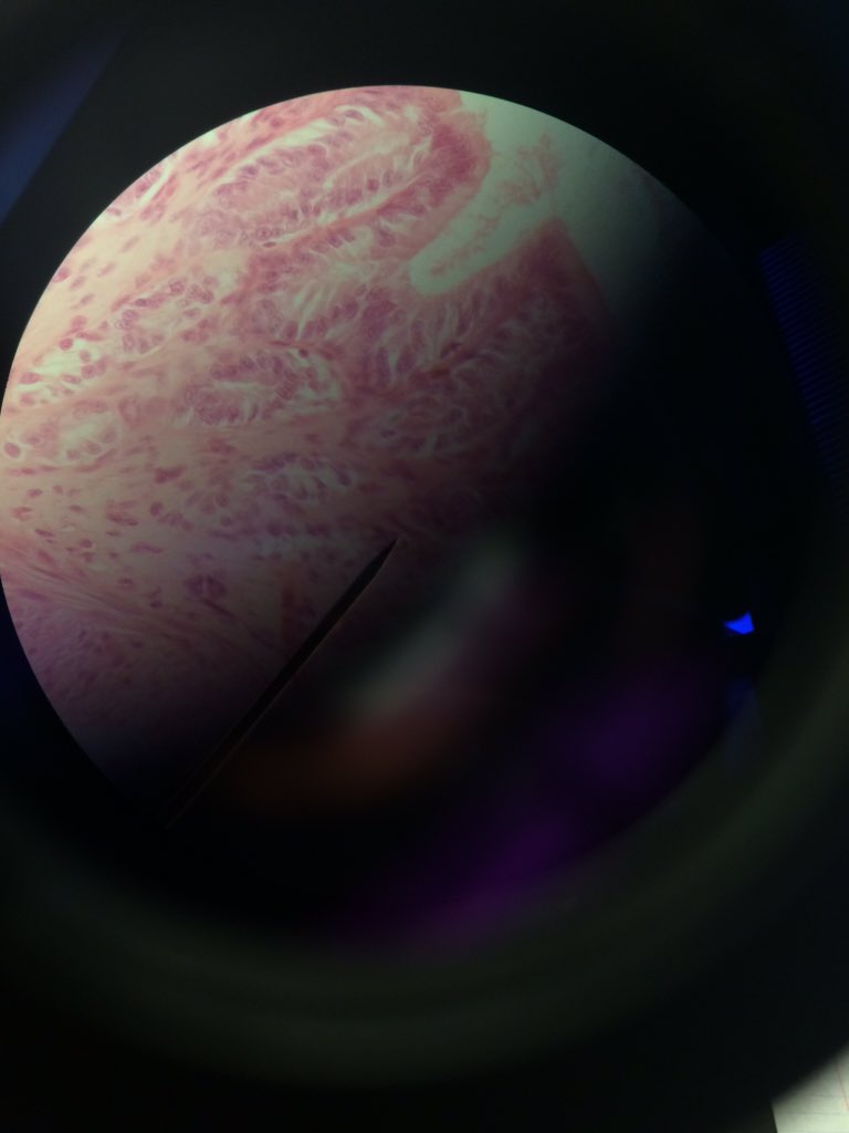 DrollKylemania's tweet photo. This is a picture I took in lab through a microscope lens and it got cut off but it looks like it could be a planet https://t.co/JXYNOXVNGe