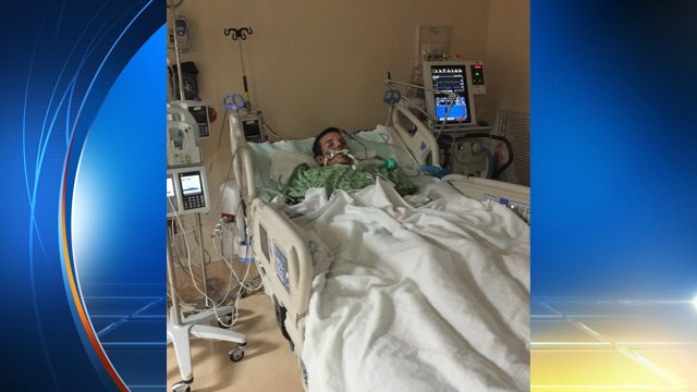 Naples man burned when e-cigarette explodes in face bit.ly/1PSYxpR?utm_me… https://t.co/lGZ32qLS2x