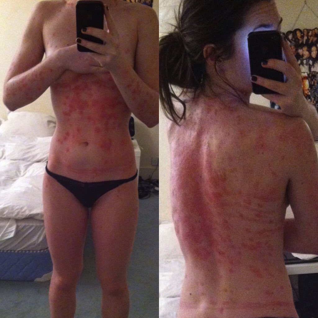 GetYourSkinOut tweet media