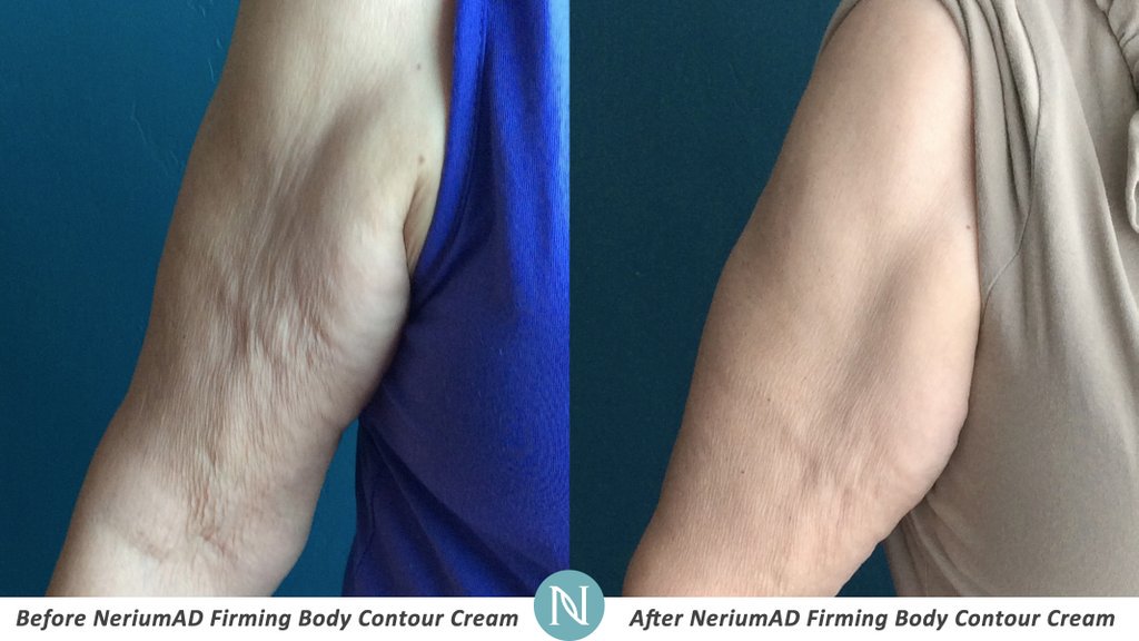 NeriumIntlMex's tweet photo. El gimnasio no puede ser para todo el mundo. Por suerte, lo es la crema Reafirmante de contorno de cuerpo de Nerium. https://t.co/nHF3fjF3Rp