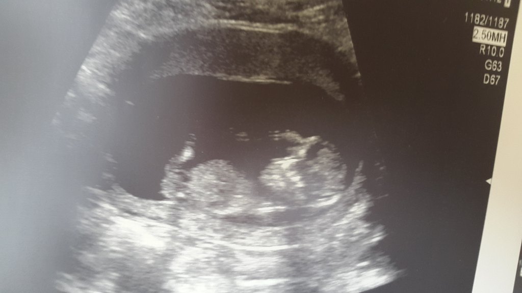 wag823's tweet photo. Well looks like I'm going to become num 2 racer in the fam soon me and @beccab823 carnt wait for our new addition https://t.co/IgfwWpQHhi