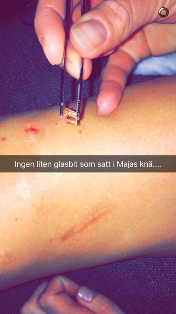 JuliaWestfelt's tweet photo. När Maja ramla på fyllan i lördags... https://t.co/Ch3mGJe6NT