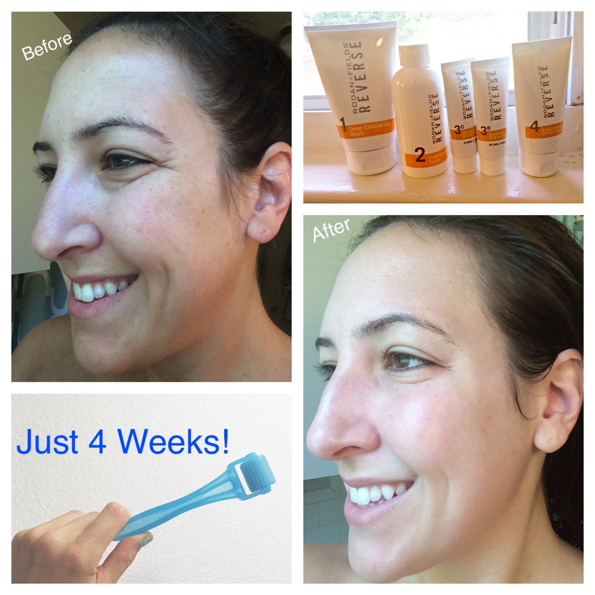 ShariDell313's tweet photo. One month w/ Rodan&amp;Fields and my skin is almost wedding ready!! Loving the products! Message me to learn more! https://t.co/2lcbWfPLdG