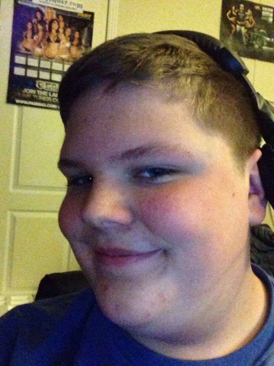 StatixN's tweet image. Can we get this 20 retweets and get this young man not only a hairline but a sense of his sexuality?