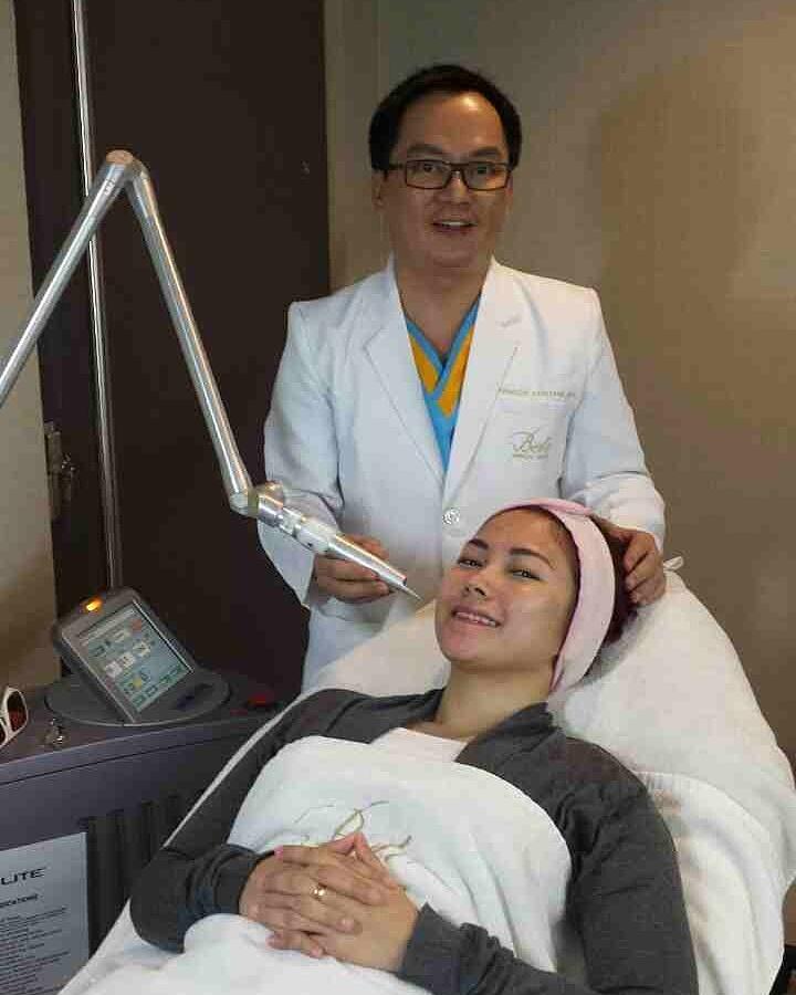 belo revlite