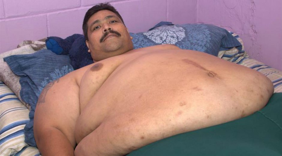 globovision's tweet photo. El hombre más obeso del mundo será operado el próximo miércoles https://t.co/ggdiw1oP7T https://t.co/GYEbBa96V7