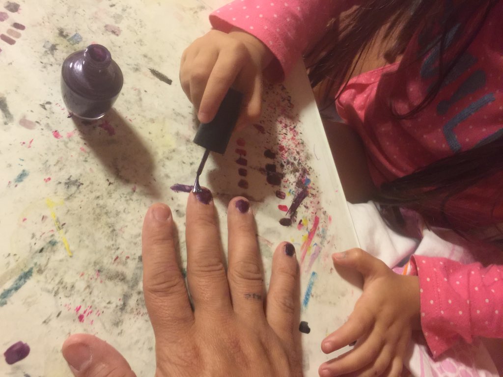 Centazzo's tweet photo. C'mon Kirky, I let my 5yr old paint mine. 
Let's see how Kate did.
@kirkmin @GerryCallahan #nailCancer #cureATRT https://t.co/XDtxYmWTZH