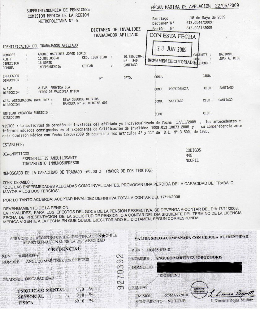 JorgeAnguloM's tweet image. Necesito juntar dinero, para una caja de parches de morfina, vale 70 lukas una y me sirve solo para 20 dias. Gracias