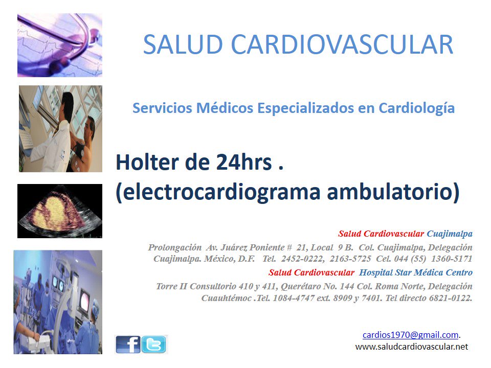 El Holter es un estudio de electrocardiografía ambulatoria que nos permite diagnosticar arritmias cardíacas.