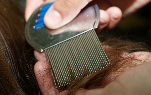 Tinylocks's tweet photo. WE END
THE STRUGGLE
WITH #NITS &amp;
#HEADLICE
– AND THAT’S
GUARANTEED
https://t.co/tcLkSkqN1G

#TinyLocks
#TinyLock https://t.co/u5D7DkE3eD