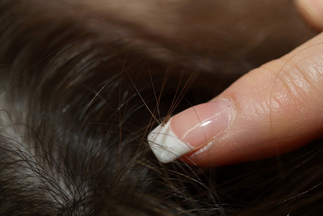 Tinylocks's tweet photo. How do lice salons and services work?
https://t.co/TLWKipBNH2 https://t.co/MBzEiSIgMT