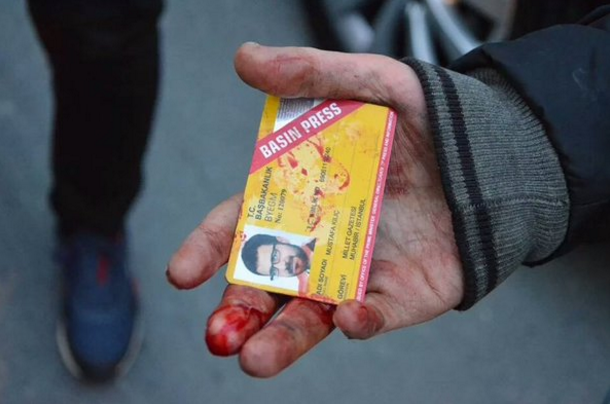 Türkiye'de özgürlükler var dersin,bir foto karesi seni yalanlamaya yeter !

#ipekmedya 
#TURKEYsMEDİAisUnderAttack