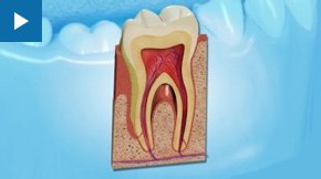 Preventive dentistry is very important to us and it should be to you too bit.ly/1IhWQv5