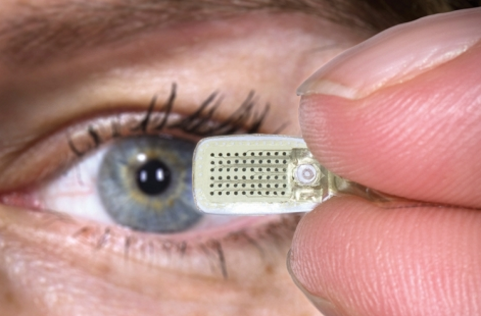 TrojanFamilyMag's tweet photo. At @USC Eye Institute, biomedical implants can do what was once impossible—restore sight. https://t.co/NZER8wxmhd https://t.co/OsjWGLDQFn