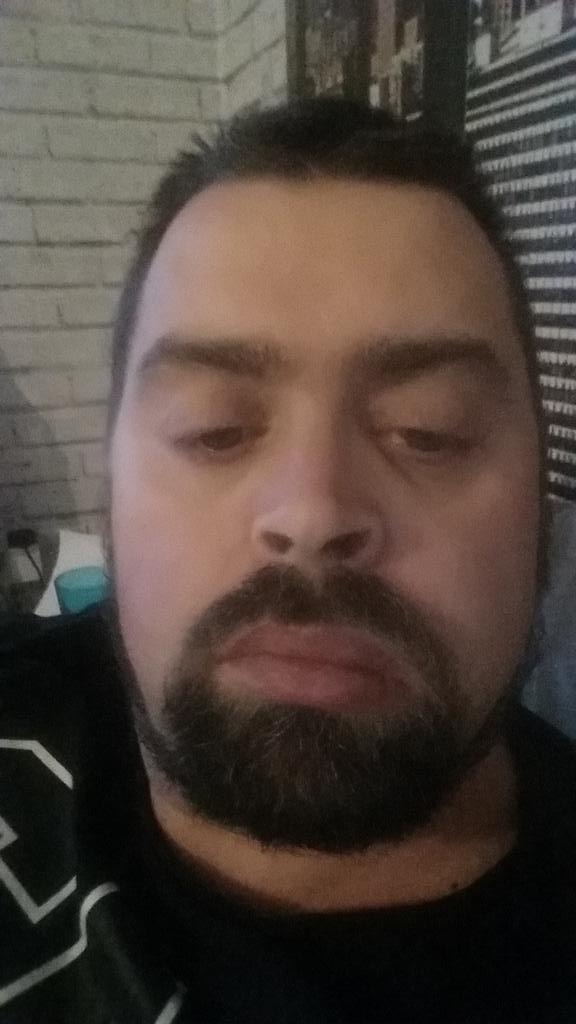 Jamie_s_Allan's tweet photo. #bossedit mli have a massive abscess on the left side of my face https://t.co/0w3qRkiEUJ