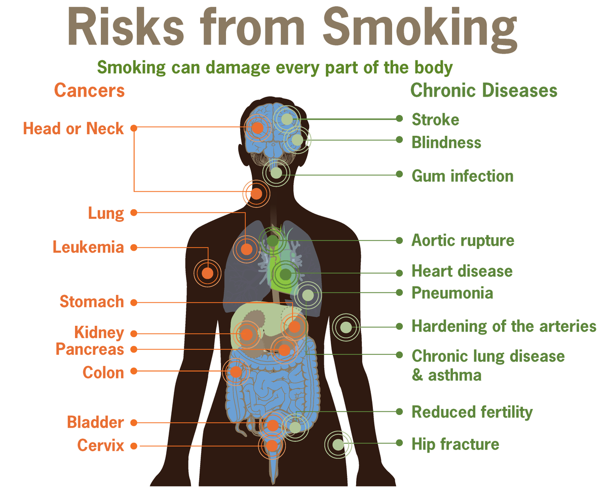 GWaveGazette's tweet photo. Is smoking still a thing? Read Jessica Barry #smoking https://t.co/jCnl9yCcFh https://t.co/Lnjq11NWR5