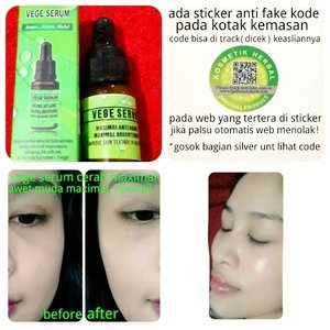NiswaShop's tweet photo. Vege serum, hasil putih alami, cerah, hasil cepat, dan tanpa efek samping. Udah BPOM. Order PIN BBM: 52588241 https://t.co/C6LnW1oQpu