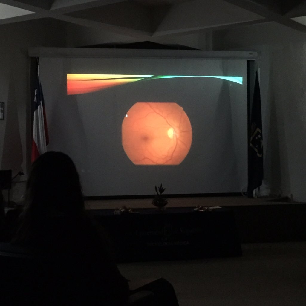 CetemuvSF's tweet photo. Expone sobre Angioflurosceinografía de retina, la TM Pilar Illanes! #JornadaTMUVSF https://t.co/L9L27mtbA2