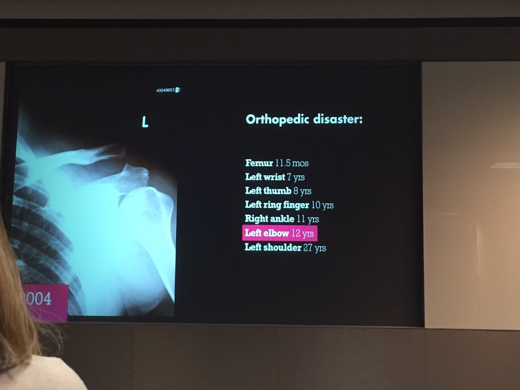 Twitter's <a href="/dwjr/">David Wright</a> just gave a great presentation to <a href="/bizjournals/">The Business Journals</a>, but the real takeaway is his orthopedic history.