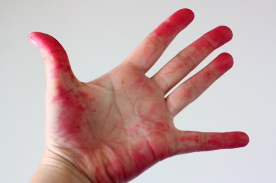 _xladymacbethx_'s tweet photo. My hands are never clean anymore, no matter how much I wash them. Any advice @WebMD ? https://t.co/N1hupbNPqX