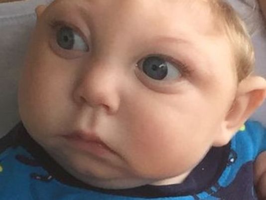KHOU's tweet photo. Baby born missing most of brain proves doctors wrong: https://t.co/eT1qCz6vaM https://t.co/pImqskjbfu
