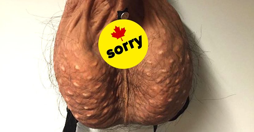 scrotum backpack