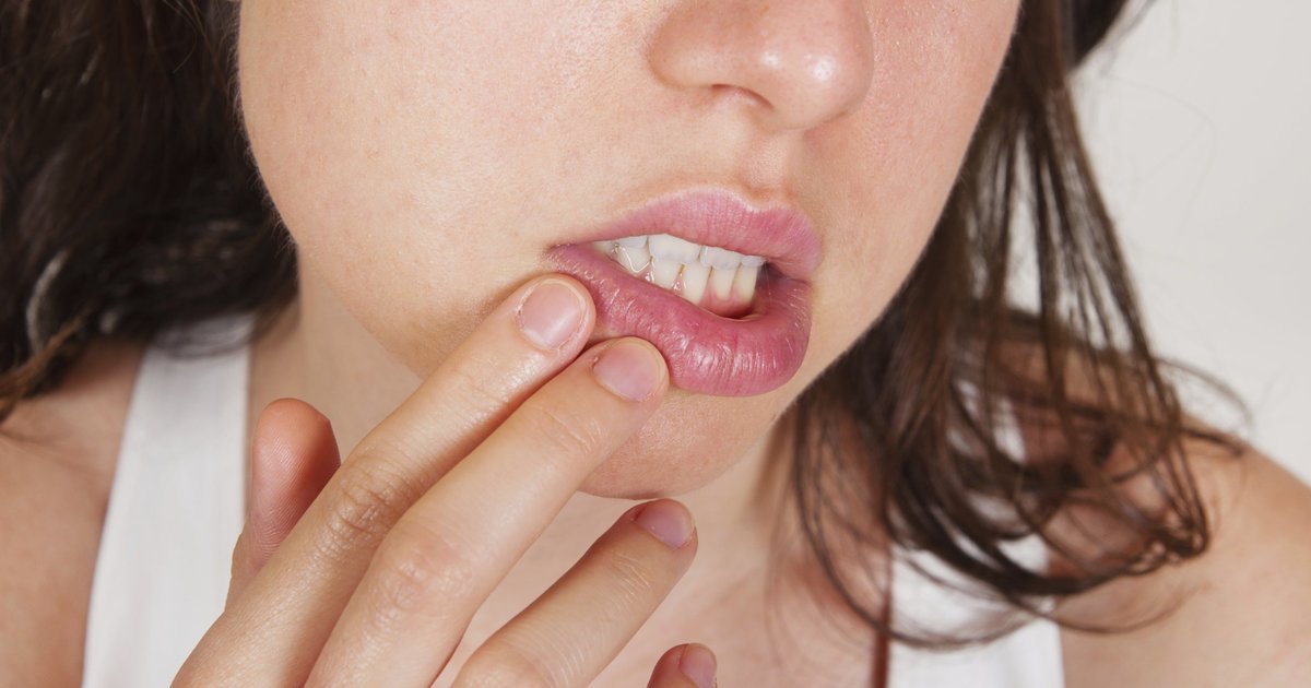 HuffPost's tweet photo. More than half the world has herpes, WHO reports
https://t.co/UHpd3cG8Lt https://t.co/aRfENn987S