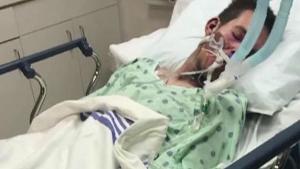 FoxNews's tweet photo. Florida man placed in a coma after e-cigarette explosion https://t.co/RmzVKHF2HU via @foxnewshealth https://t.co/nAP6w5br88