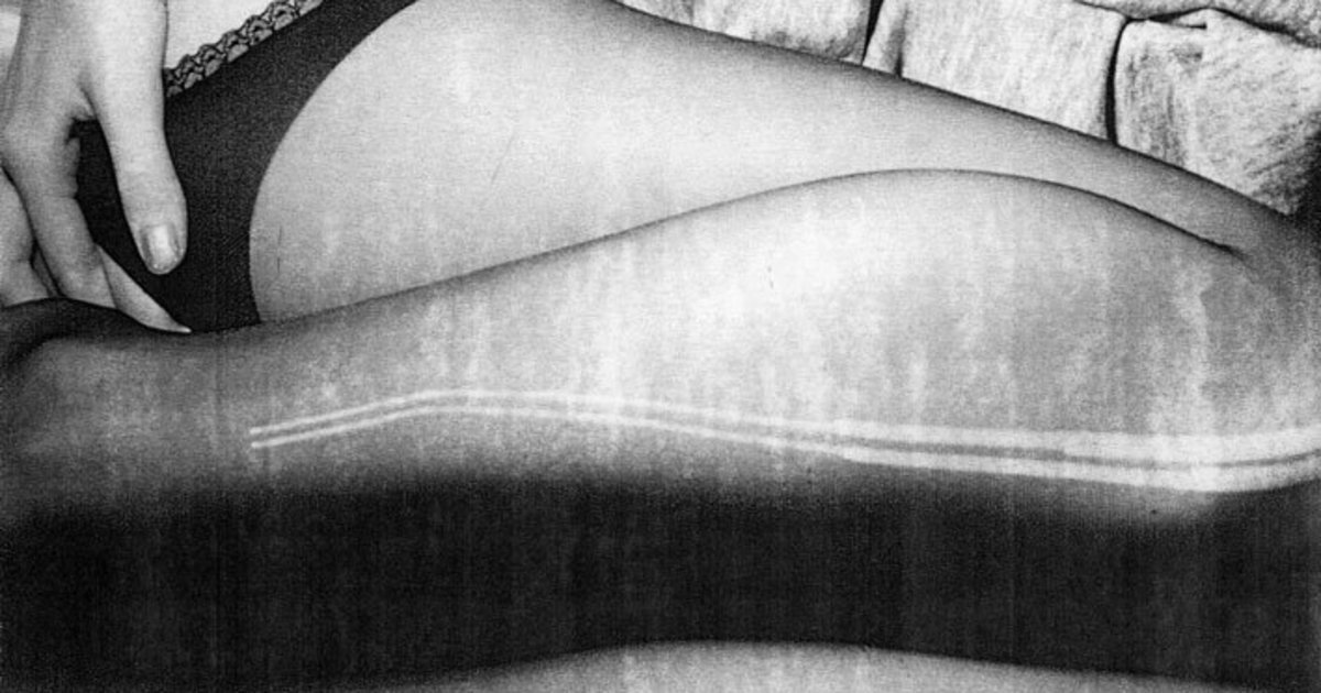 HuffPost's tweet image. Intimate self-portraits document one artist's struggle with disease huff.to/1MsWwRE