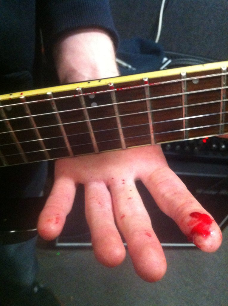 We bleed for the metal! #MetalMakesMeBleedMyOwnBlood #Blood #metal #Tacitus #Guitar