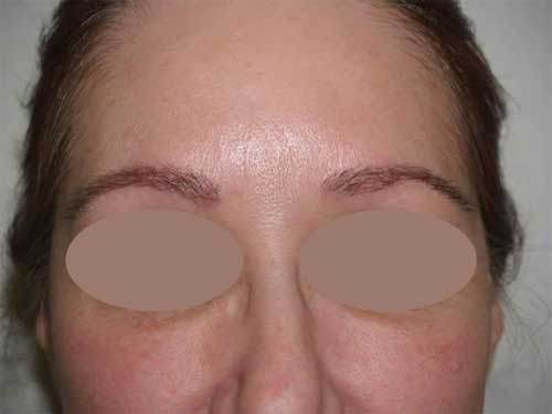 Clinicas_CMA's tweet photo. El #trasplantecapilar devuelve tus cejas a la vida (Belleza Pura) #implantedecejas https://t.co/6n1i8azIrR https://t.co/OsFHzt2phv