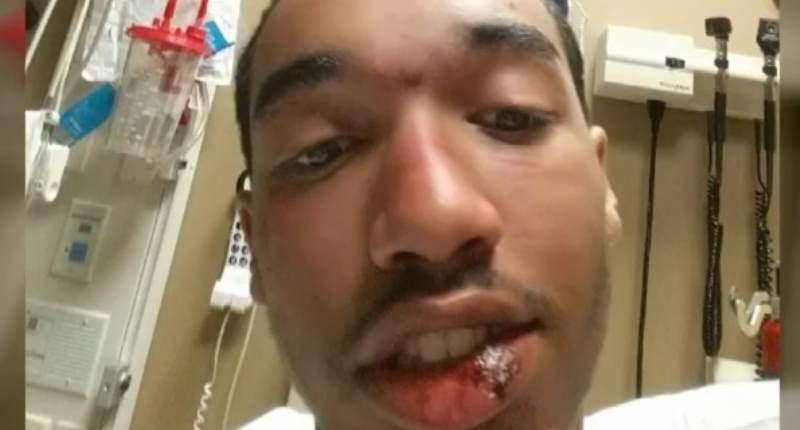 NuBlackVision's tweet photo. #TransitCop fired after beating Minn #Autistic teen #MarcusAbrams suspected of drug use! https://t.co/Jp8FknE6uc https://t.co/z1HlMRnBVQ