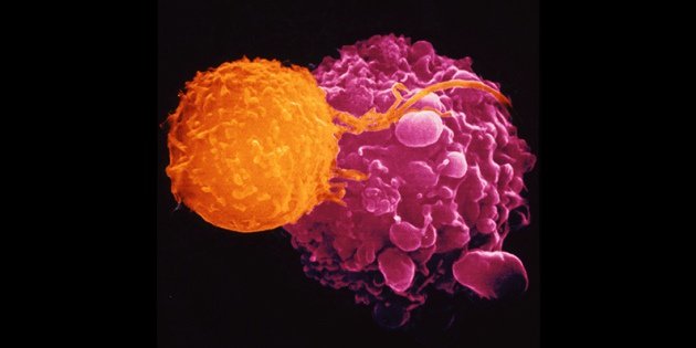 Nature's tweet photo. First cancer-fighting virus approved in US to treat advanced melanoma https://t.co/yORlgKJlH8 https://t.co/7MC2tSyvGN