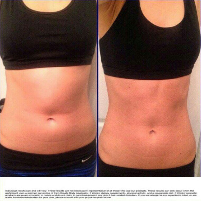 KatieV_ItWorks's tweet photo. After just 12 hours from one wrap!!!!! Imagine what your results could be in 12 hours! call/text Katie 502-709-2918 https://t.co/uvldRZVbBU
