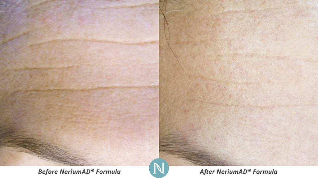 NeriumIntlMex's tweet photo. Nerium puede darle ese brillo saludable que has estado buscando! https://t.co/hShhJvYjEv
